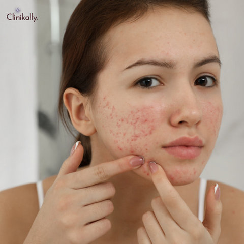 centella asiatica skin benefits