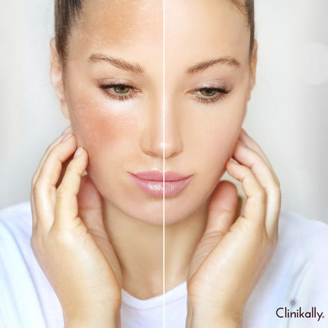 How to brighten dry dull skin