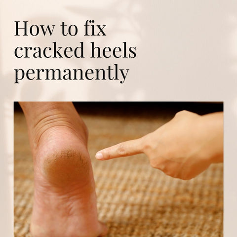 How to fix cracked heels permanently