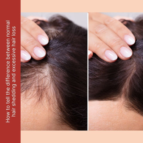 How to tell the difference between normal hair shedding and excessive hair loss