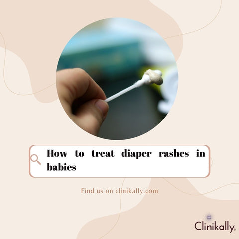 How to treat diaper rashes in babies