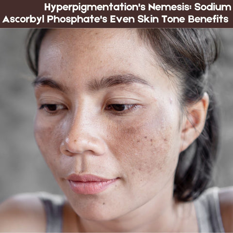 Hyperpigmentation's Nemesis: Sodium Ascorbyl Phosphate's Even Skin Tone Benefits