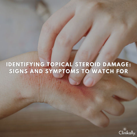 Identifying Topical Steroid Damage: Signs and Symptoms to Watch For