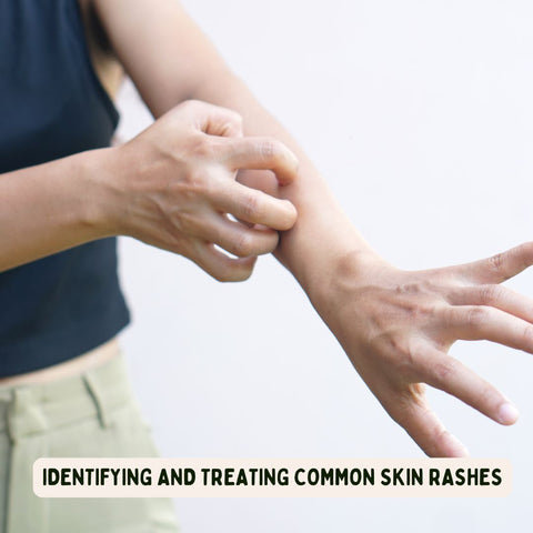 Identifying and Treating Common Skin Rashes