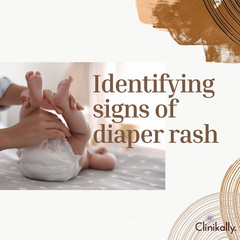 Identifying signs of diaper rash