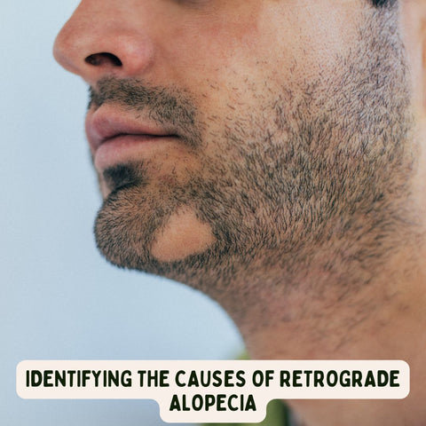 Identifying the Causes of Retrograde Alopecia