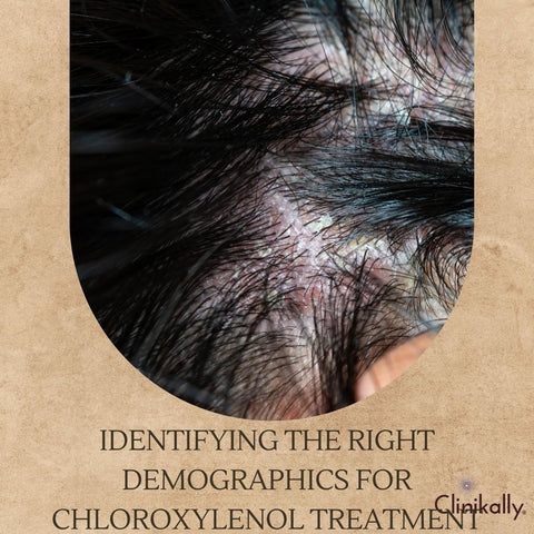 Identifying the Right Demographics for Chloroxylenol Treatment