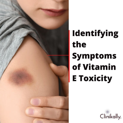 Identifying the Symptoms of Vitamin E Toxicity