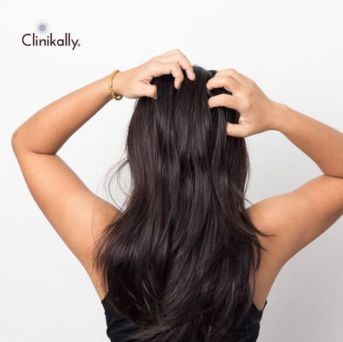 Decoding Scalp Acne: Understanding Causes and Finding Solutions