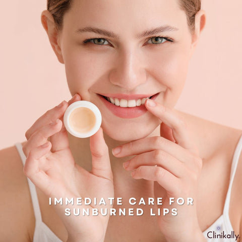 Immediate Care for Sunburned Lips