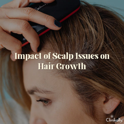 Impact of Scalp Issues on Hair Growth