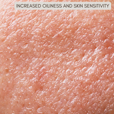 Increased Oiliness and Skin Sensitivity