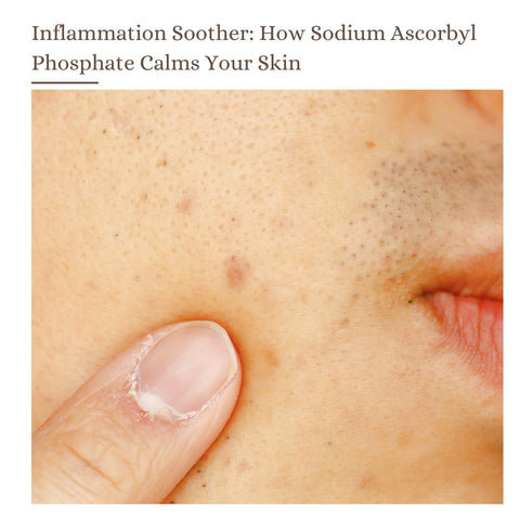 Inflammation Soother: How Sodium Ascorbyl Phosphate Calms Your Skin