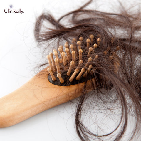 Does Pre-Workout Supplements Cause Hair Loss