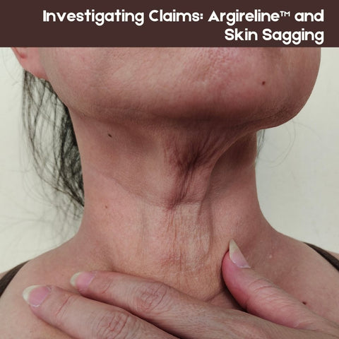 Investigating Claims: Argireline™ and Skin Sagging