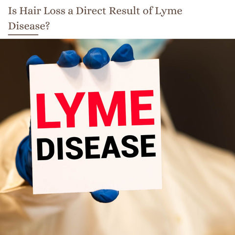 Is Hair Loss a Direct Result of Lyme Disease?