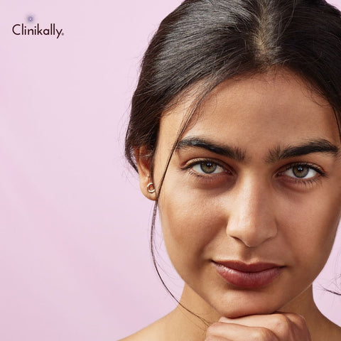 Is slugging suitable for all skin types?