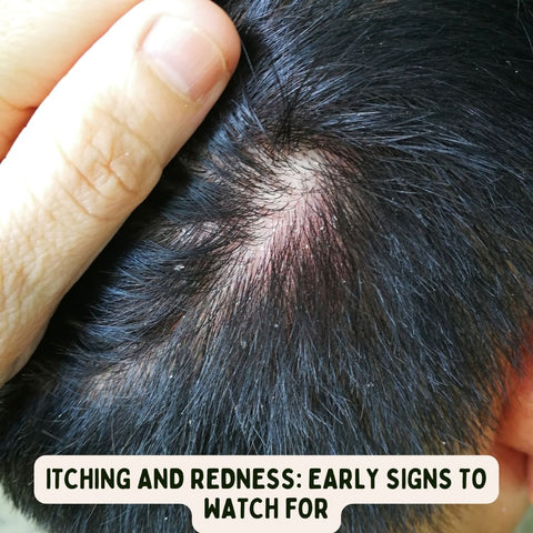 Itching and Redness: Early Signs to Watch For