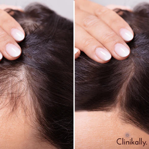 Best Redensyl products on the market