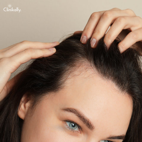 dandruff vs dry scalp