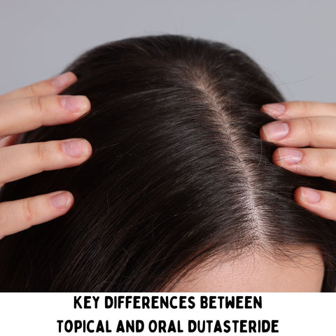 Key Differences Between Topical and Oral Dutasteride