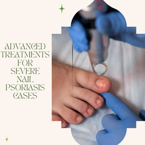 Advanced Treatments for Severe Nail Psoriasis Cases