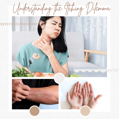 Understanding the Itching Dilemma