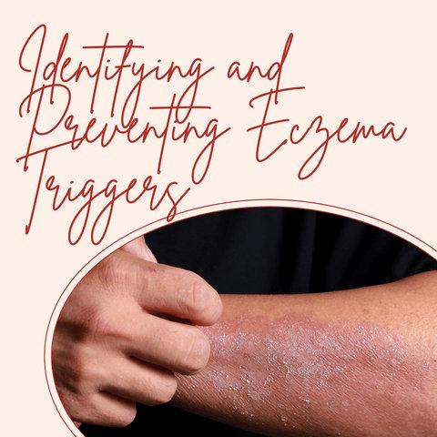 Identifying and Preventing Eczema Triggers