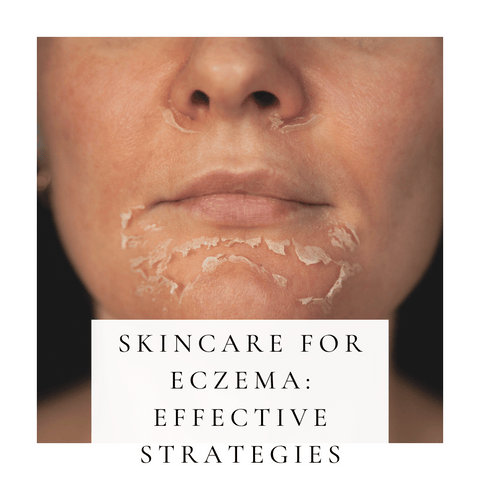Skincare for Eczema: Effective Strategies