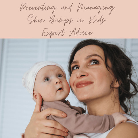 Preventing and Managing Skin Bumps in Kids: Expert Advice