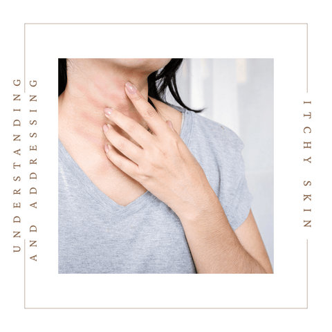 Understanding and Addressing Itchy Skin