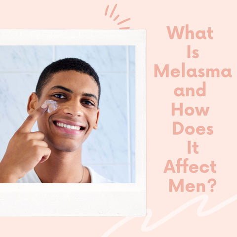 What Is Melasma and How Does It Affect Men?