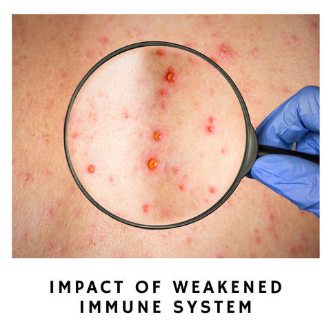 Impact of Weakened Immune System