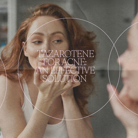 Tazarotene for Acne: An Effective Solution