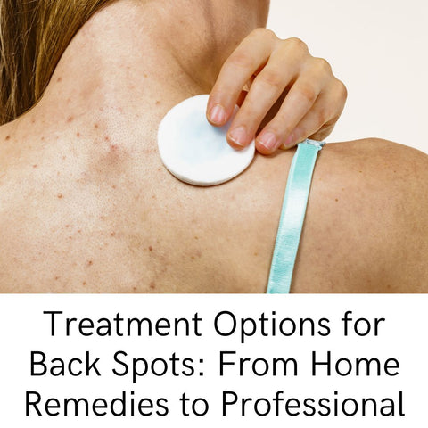 Treatment Options for Back Spots: From Home Remedies to Professional Solutions