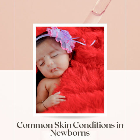 Common Skin Conditions in Newborns