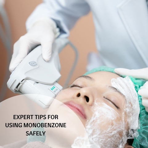 Expert Tips for Using Monobenzone Safely