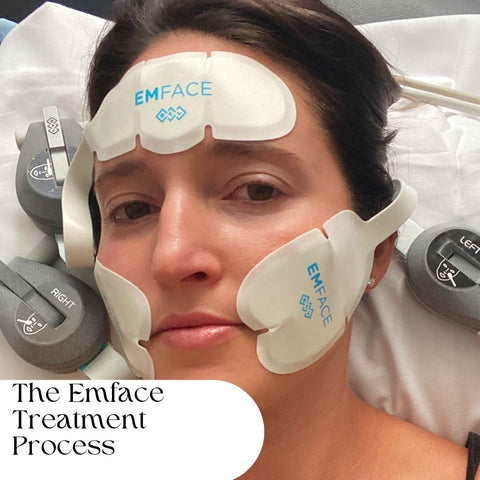 The Emface Treatment Process