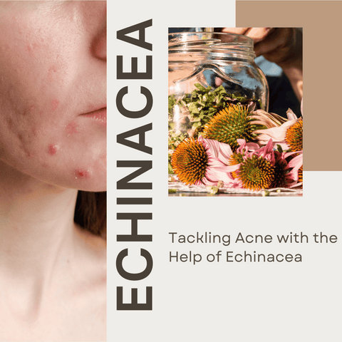 Tackling Acne with the Help of Echinacea