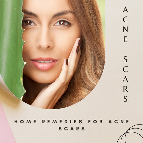 Home remedies for acne scars