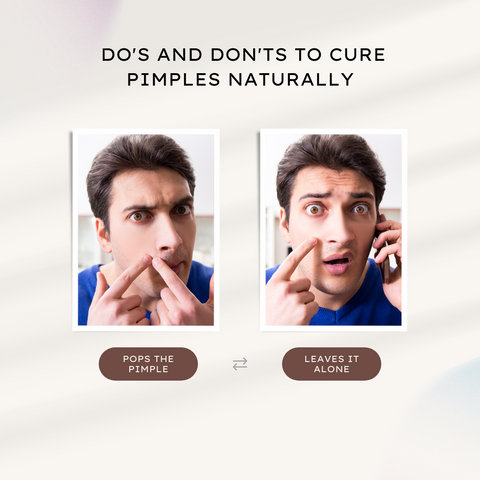 Do's and don'ts to cure pimples naturally