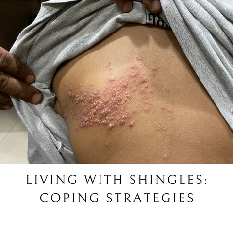Living with Shingles: Coping Strategies