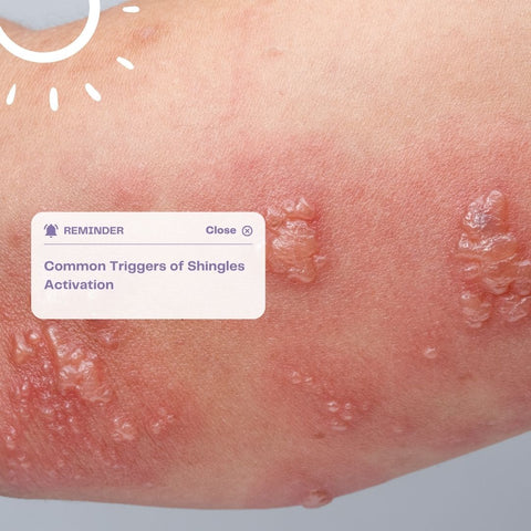 Common Triggers of Shingles Activation
