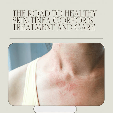 The Road to Healthy Skin: Tinea Corporis Treatment and Care