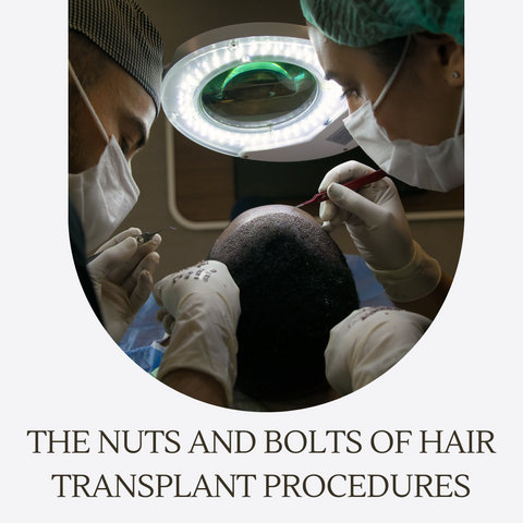 The Nuts and Bolts of Hair Transplant Procedures