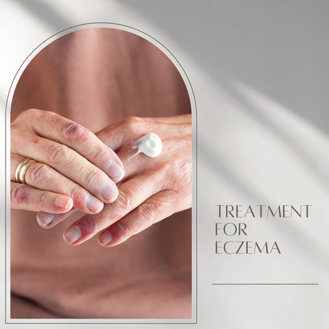 Treatment for eczema