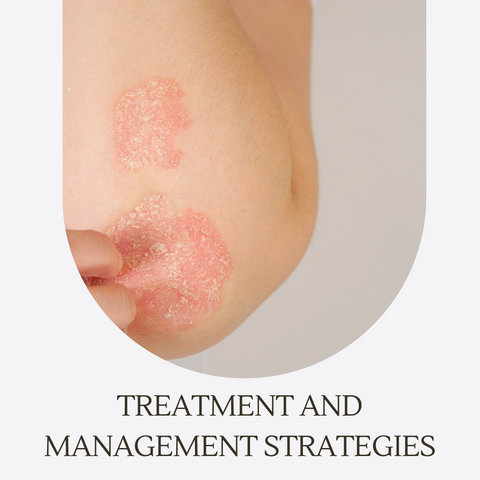 Treatment and Management Strategies