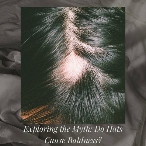 Exploring the Myth: Do Hats Cause Baldness?