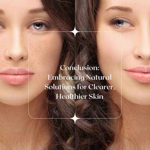 Conclusion: Embracing Natural Solutions for Clearer, Healthier Skin