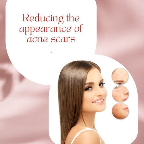 #4 Reducing the appearance of acne scars